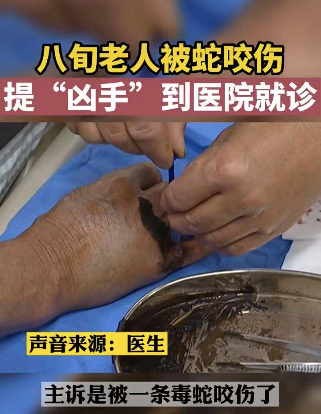 福建女子被蛇咬后续,福建女子被狗咬伤视频