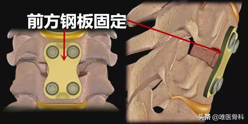 乳腺微创手术和开放手术的区别,开放手术和微创手术的区别