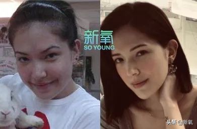 盘点整容后不敢认的女星颜值巅峰,知名女网红被扒整容