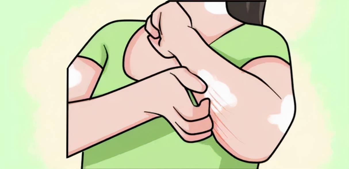 荨麻疹很痒忍下来有用吗,荨麻疹实在太痒了可以输液缓解嘛