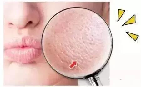 李佳琦私藏款，堪称“毛孔吸尘器”的面膜只要白菜价！