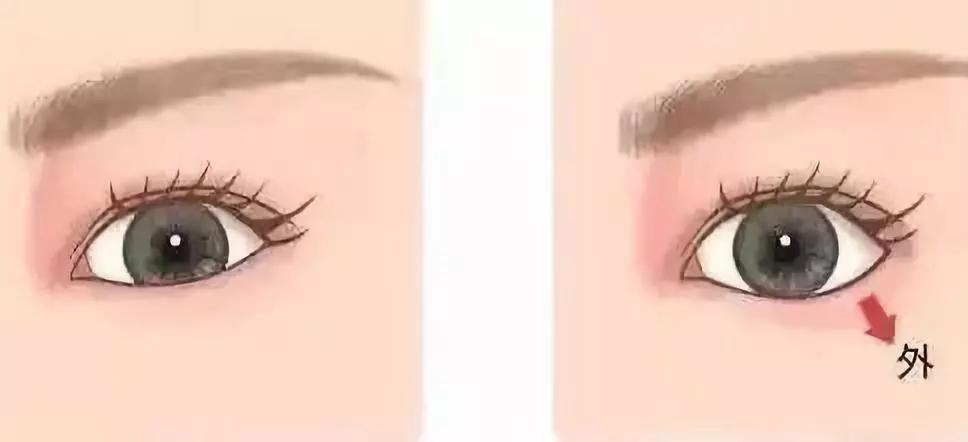 医美最火的项目,哪些皮肤类医美项目不建议做