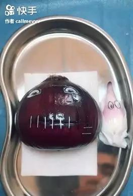香蕉割包皮，洋葱剖腹产？这是我见过最秀的医生