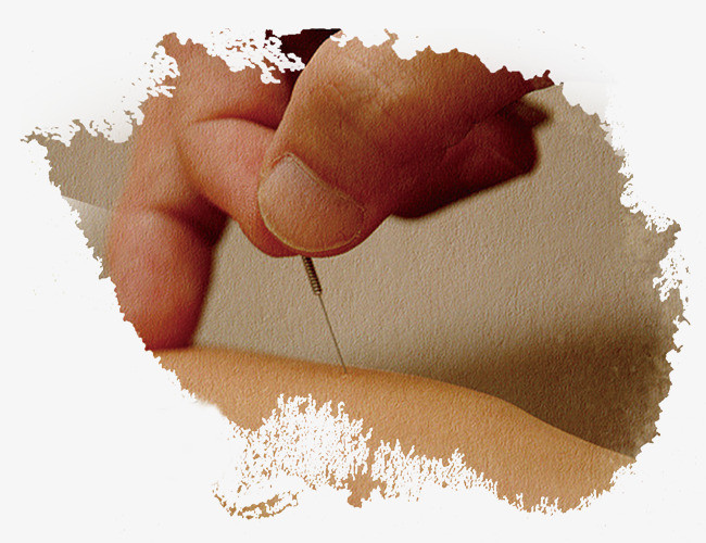 扎针灸晕针了明天还能接着扎吗,针灸时出现晕针状况应该怎么处理