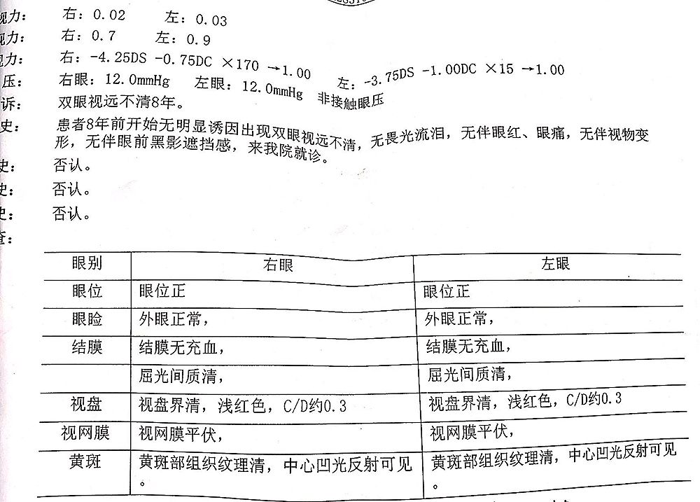 戴隐形眼镜能不能做近视散光手术,隐形眼镜可以近视加散光吗