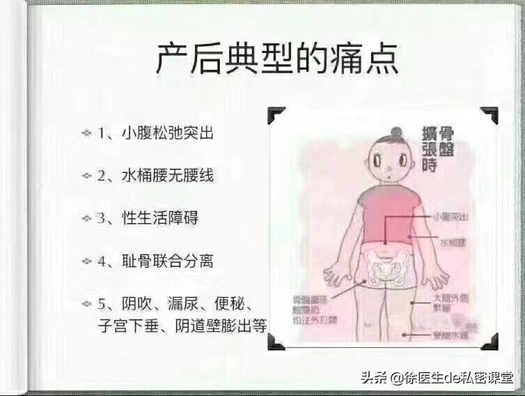 普拉提环产后修复,梵一瑜伽普拉提产后修复私教