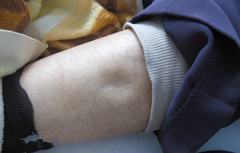 脚丫子都肿是什么原因造成的,脚丫子痛不肿关节痛怎么回事