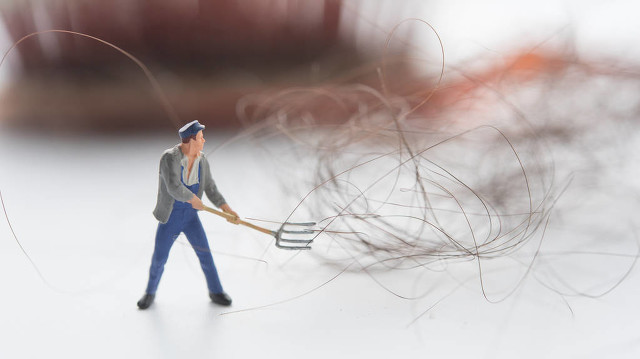 掉头发是什么原因引起的怎么调理,女人掉头发厉害是什么原因引起的