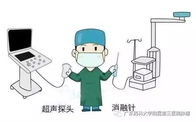 消融法治疗恶性肿瘤的疗效,消融术是消融良性还是恶性肿瘤