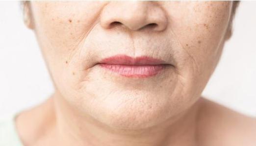 鱼尾纹法令纹抬头纹显老又难看,法令纹鱼尾纹抬头纹哪个最难看