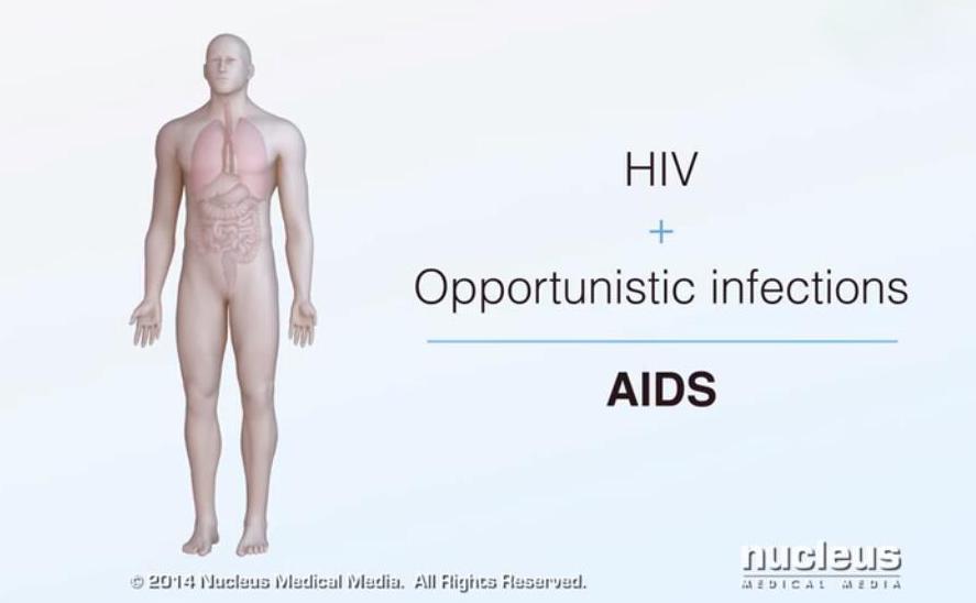 今天的艾滋病新闻,今天艾滋病最新进展