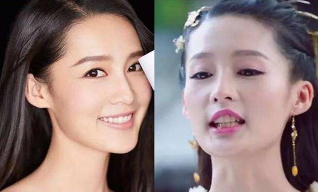 揭露欧美明星牙齿美白的秘密,牙齿美白最好的方法大黄牙