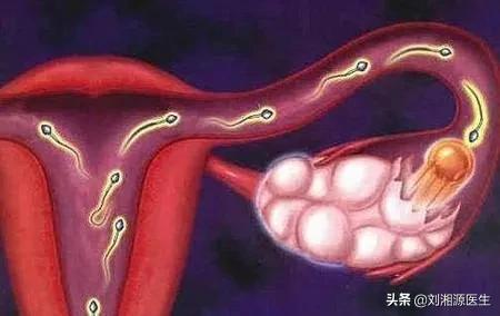 【免疫相关不良妊娠答疑解惑15】——辅助生殖(4)