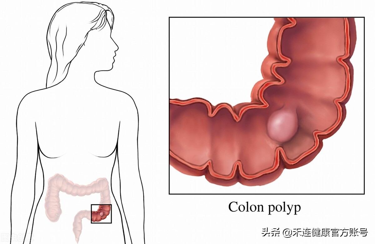 腹痛便血大便下坠感什么原因,腹部隐痛且便血是什么症状