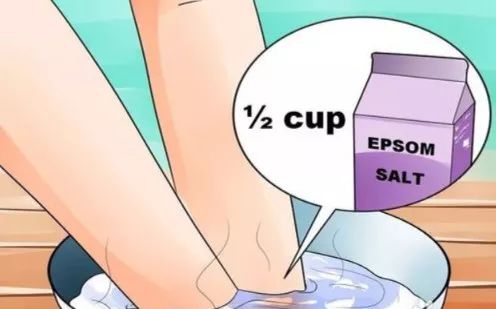 如何预防与处理比跑步膝痛还烦人的水泡？