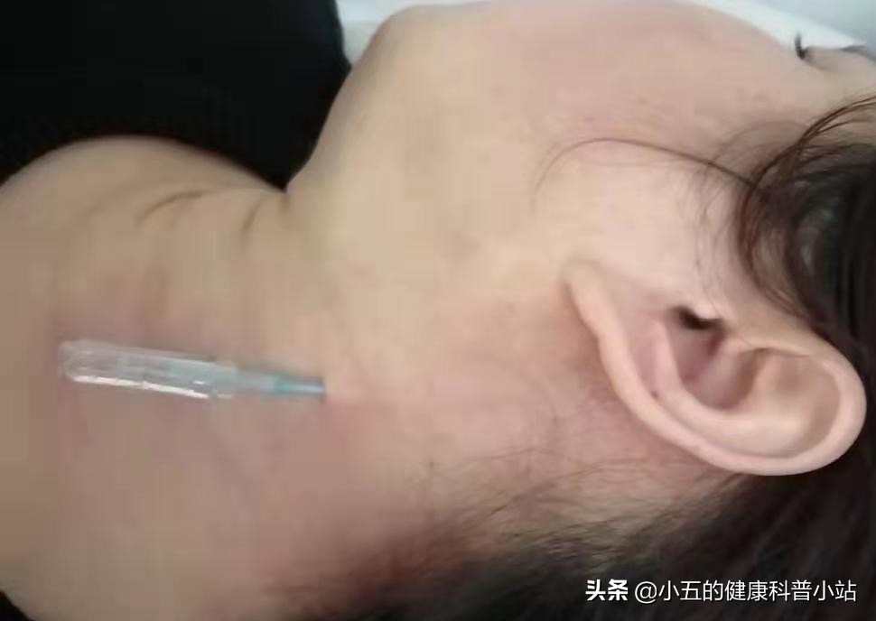 浜ㄧ壒缁煎悎寰佺殑鐗圭偣,浜ㄧ壒缁煎悎寰佺殑鐗瑰緛