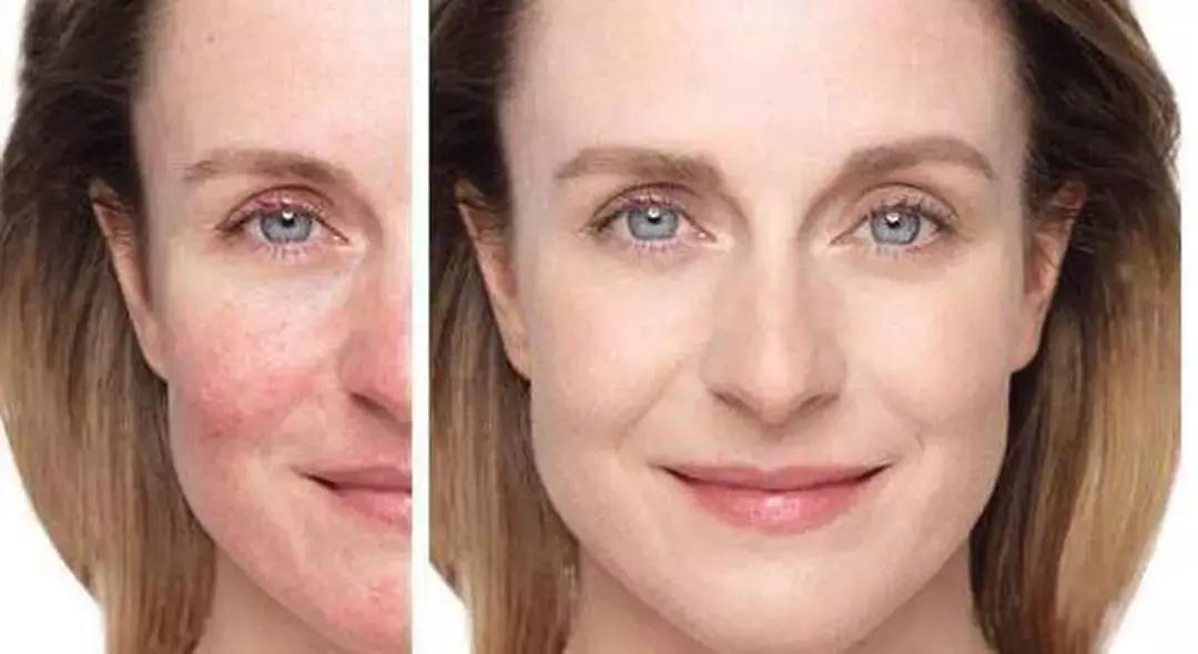 小棕瓶美妆测评,小黑瓶小红瓶小棕瓶哪个好用