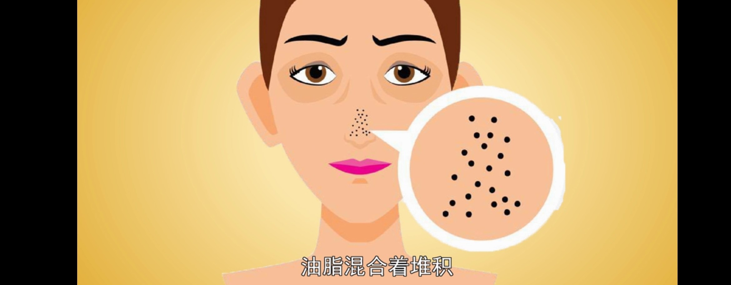 去黑头你真的用对了吗,真的好用的去黑头方法