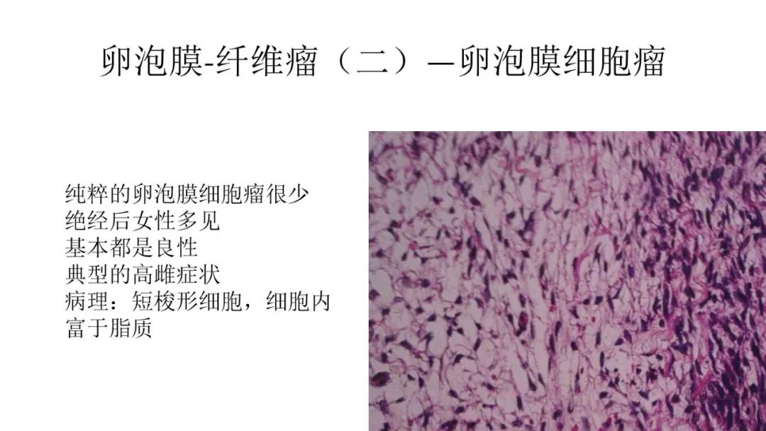 卵巢原发肿瘤的分析思路