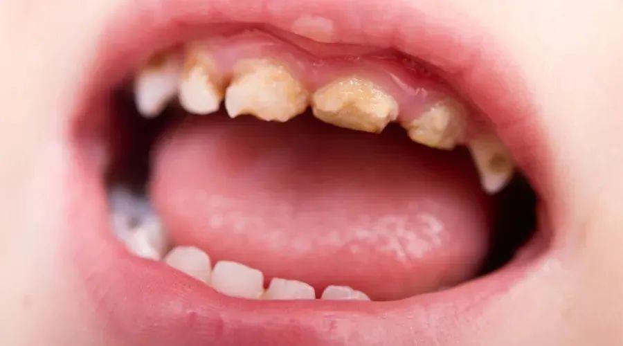 一岁多宝宝不愿意换奶瓶怎么办,一岁半宝宝戒奶瓶的好办法