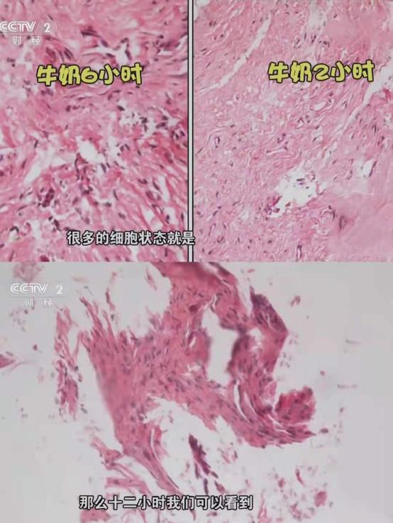 头上秃了一块还能长回来吗,二十三岁头秃还能长回来吗