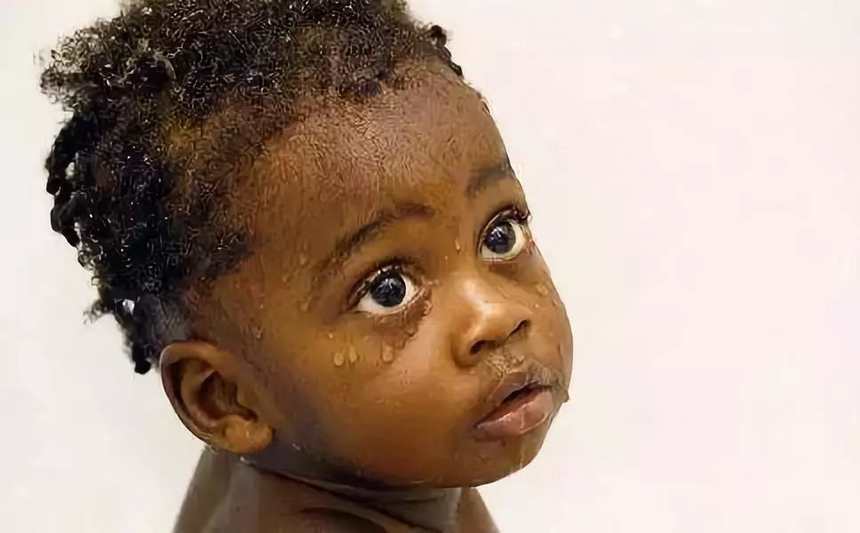 小孩和艾滋病拥抱牵手会传染吗,跟小孩解释艾滋病传播