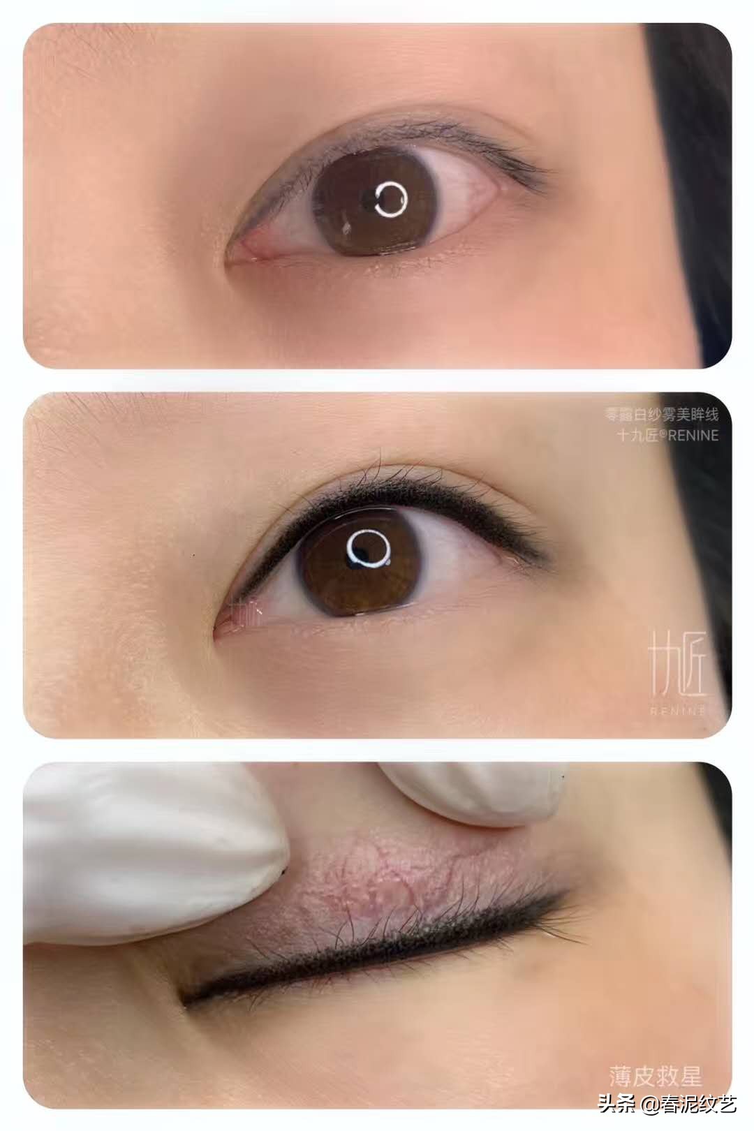 纹了美瞳线后眼睛肿怎么回事,摘完美瞳眼睛发红