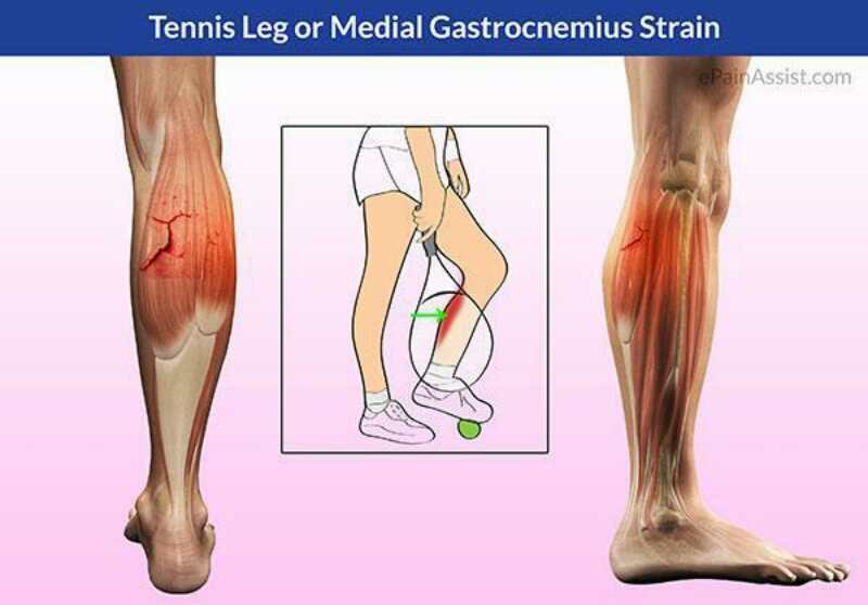 骨折软组织损伤多久恢复,软组织韧带损伤撕裂怎么治