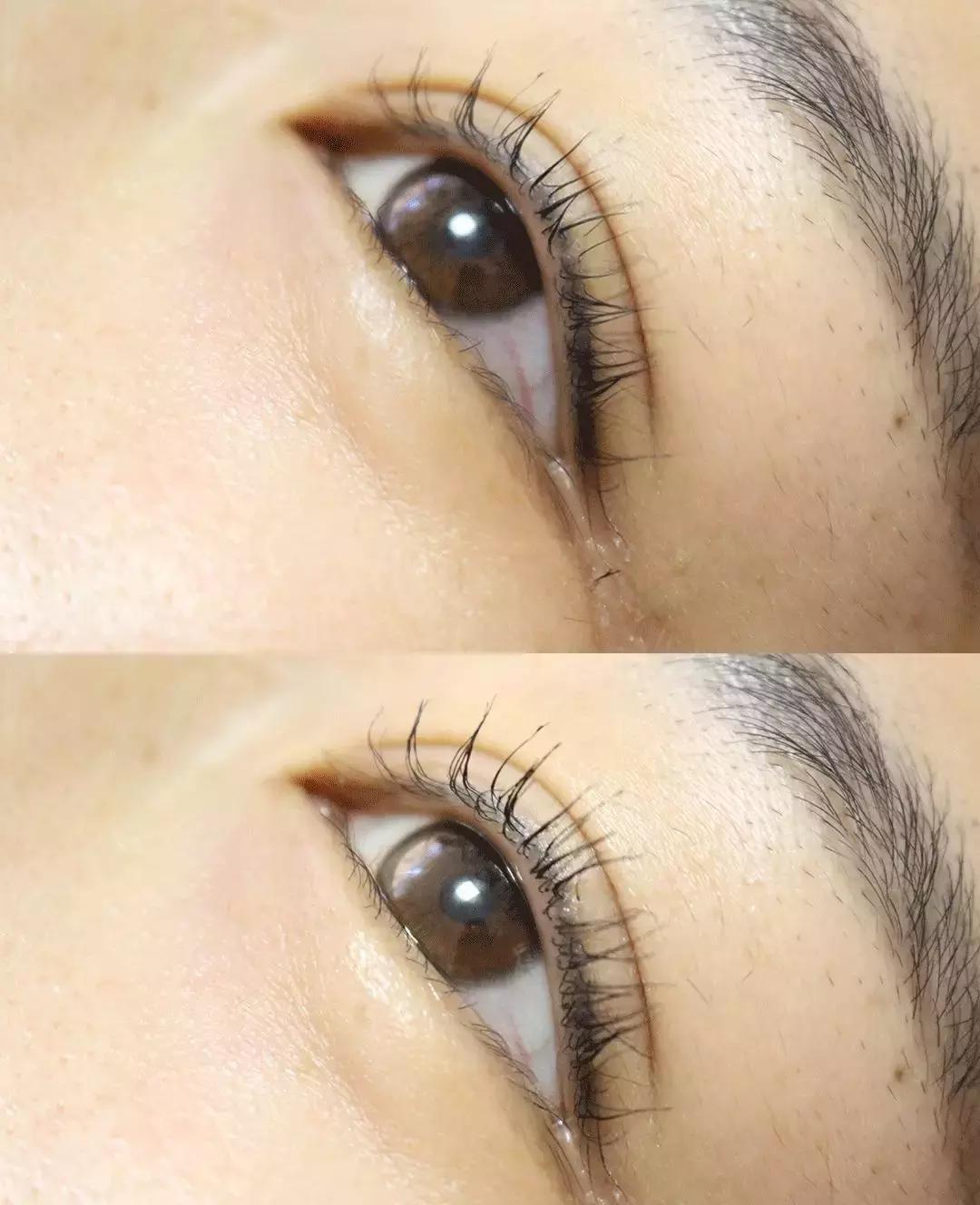 鑺辩摚缇庡鎶よ偆,鑺辩摚鎶よ偆