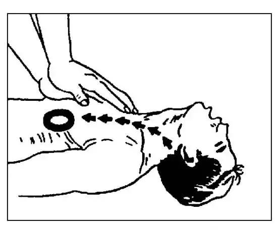 触电解救方法有哪些,触电救法