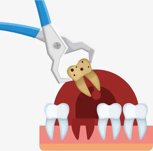 拔牙会引起肺部感染症状,女生拔牙感染