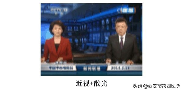 中医认为散光是怎么造成的,医生怎么发现散光