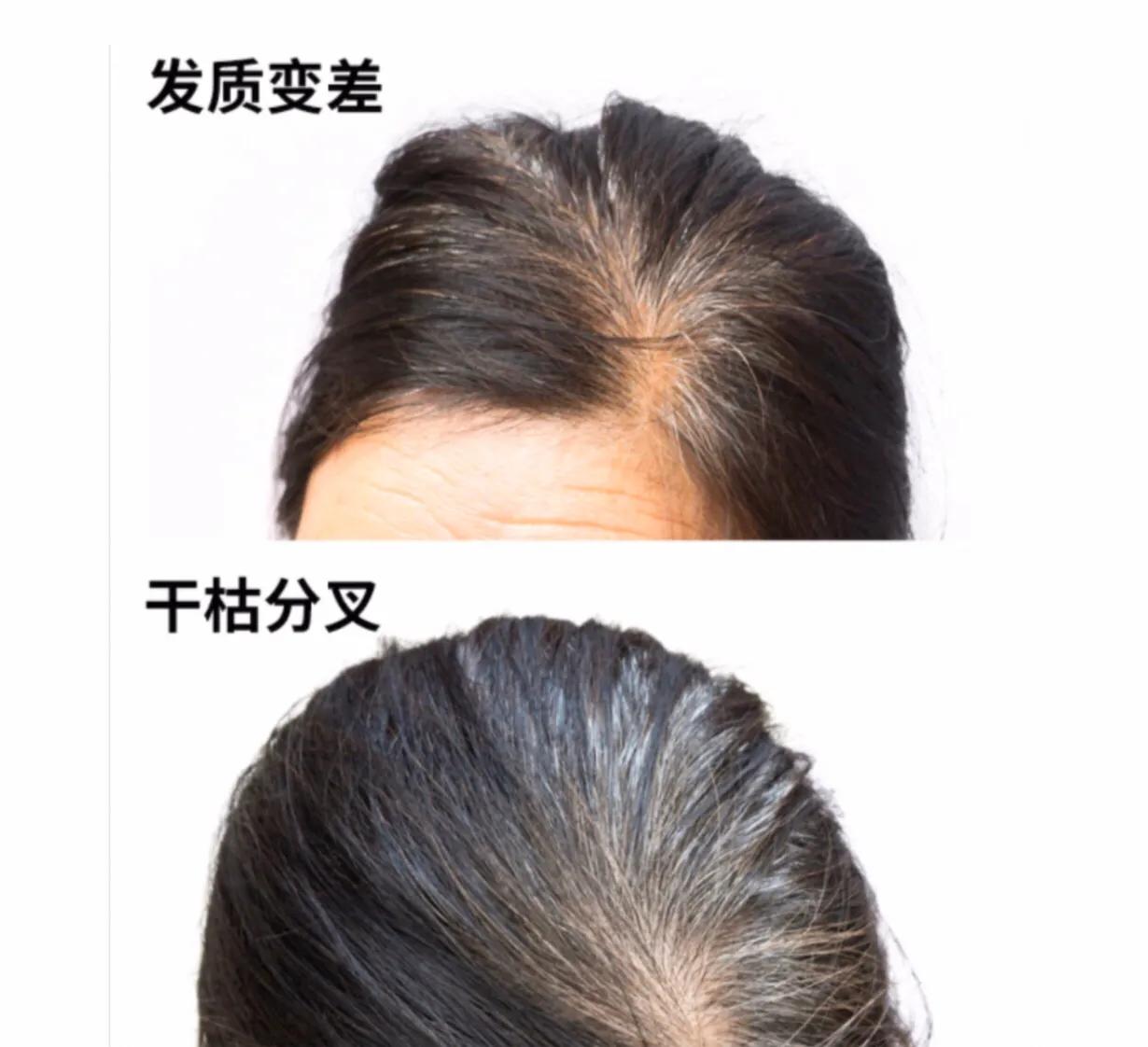 长了白头发，怎样避免和减缓染发的次数，五种方法告诉你