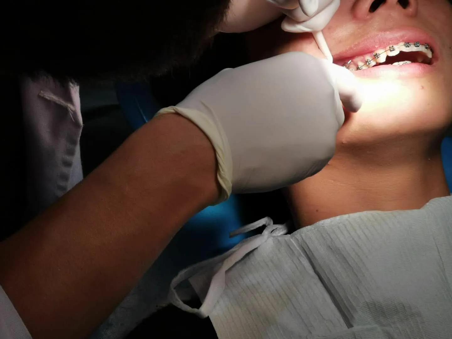 戴了牙套会更好看吗,戴了牙套有后遗症吗