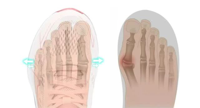合脚的鞋子才是适合自己的,合脚的鞋才是最好的鞋