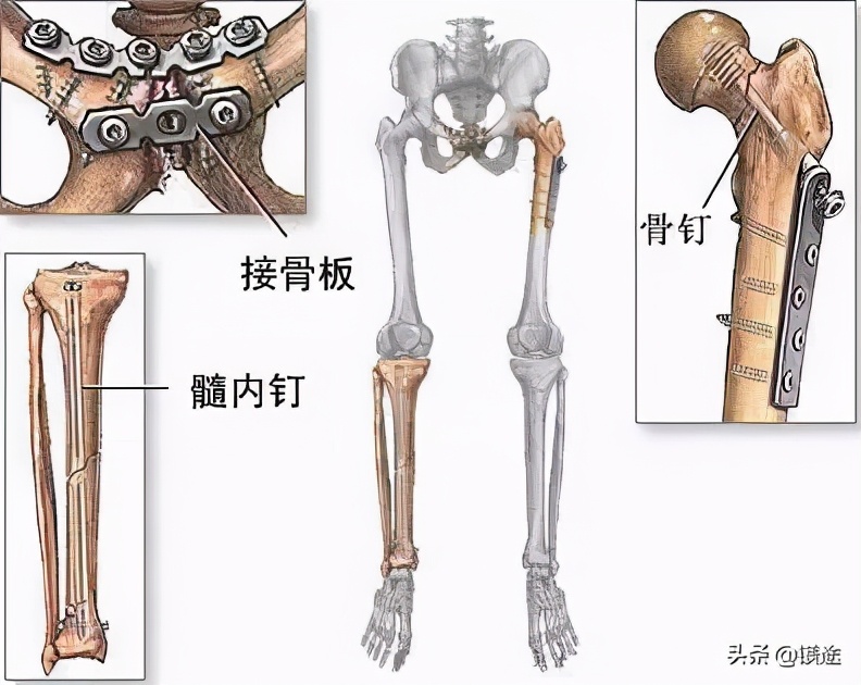 镁合金材料发展现状趋势及展望,镁的发展前景