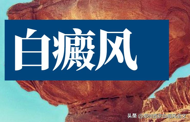 白癜风对我们的身体有哪些影响,白癜风对身体有何影响