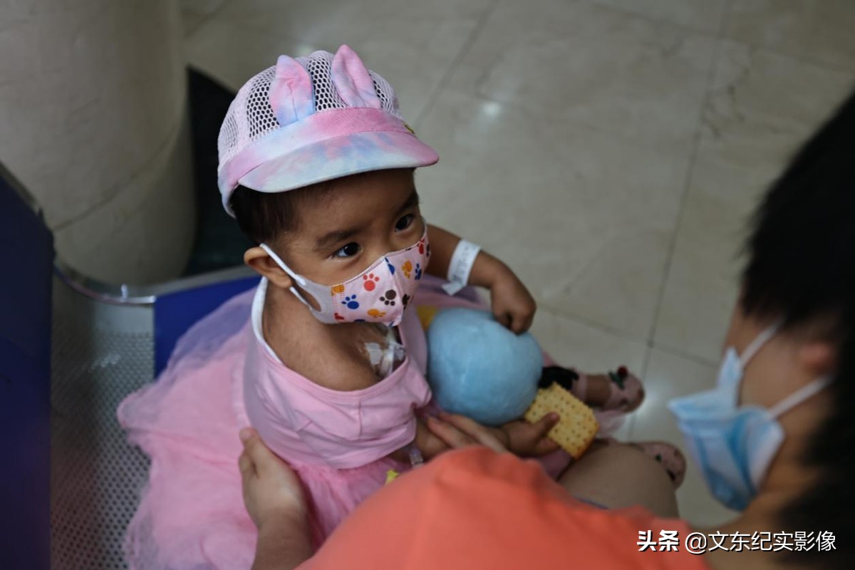 孩子嘴唇白需要到医院做啥检查吗,小孩嘴唇破裂怎么回事