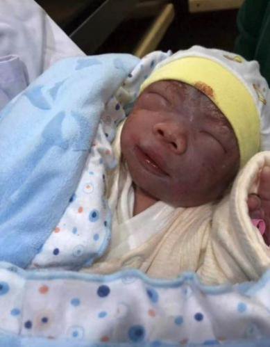 怎么判断新生儿长得丑,新生儿丑和不丑的长大区别