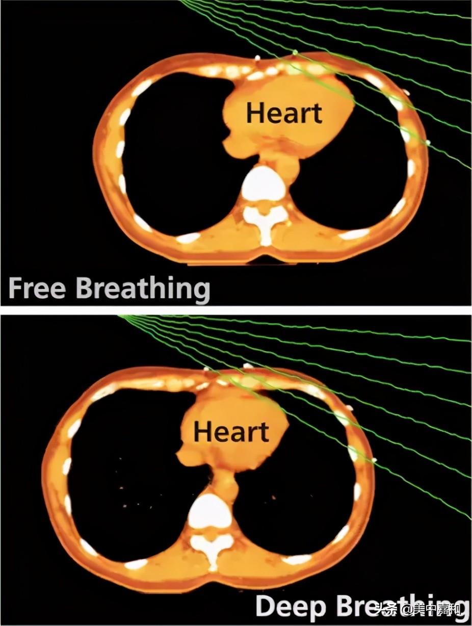 乳腺癌治疗和不治疗病人哪个痛苦,乳腺癌康复期前三年注意什么
