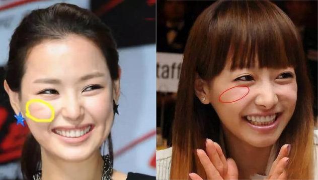 「印第安纹」*伤杀**力多大？让少女秒变大妈