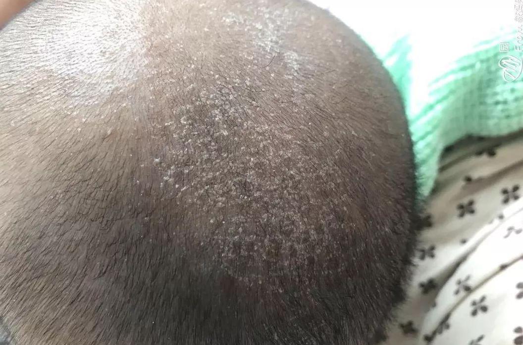 给刚出生的宝宝洗澡时，这三个部位别勤洗，对宝宝身体是一种伤害