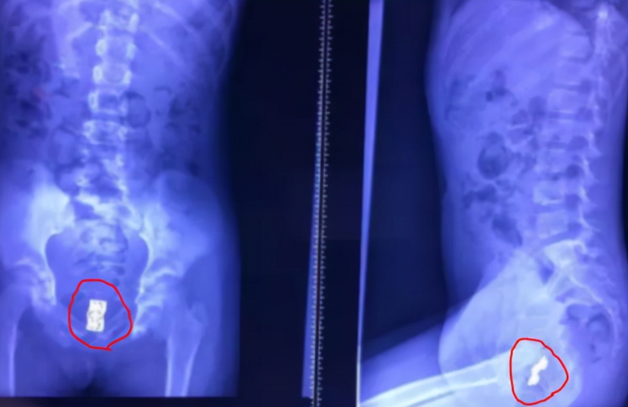 6岁的女孩有异味怎么回事,六岁女孩有异味是怎么回事