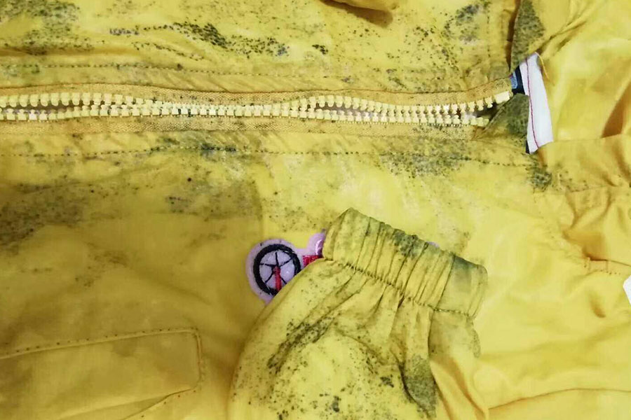 衣服上发霉了怎么处理，白醋跟牛奶可以处理，樟脑丸可以预防