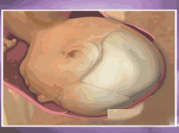 顺产开十指是十根手指宽吗,顺产开十指要侧切吗