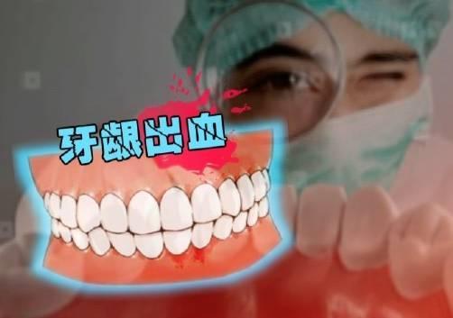 为什么使劲吸牙齿就会出血,为什么用力一吸就出血