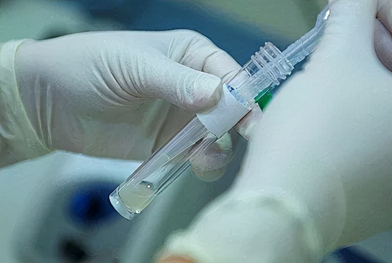 精子浓度低和精子总数少原因,精子量少怎样增加精子量