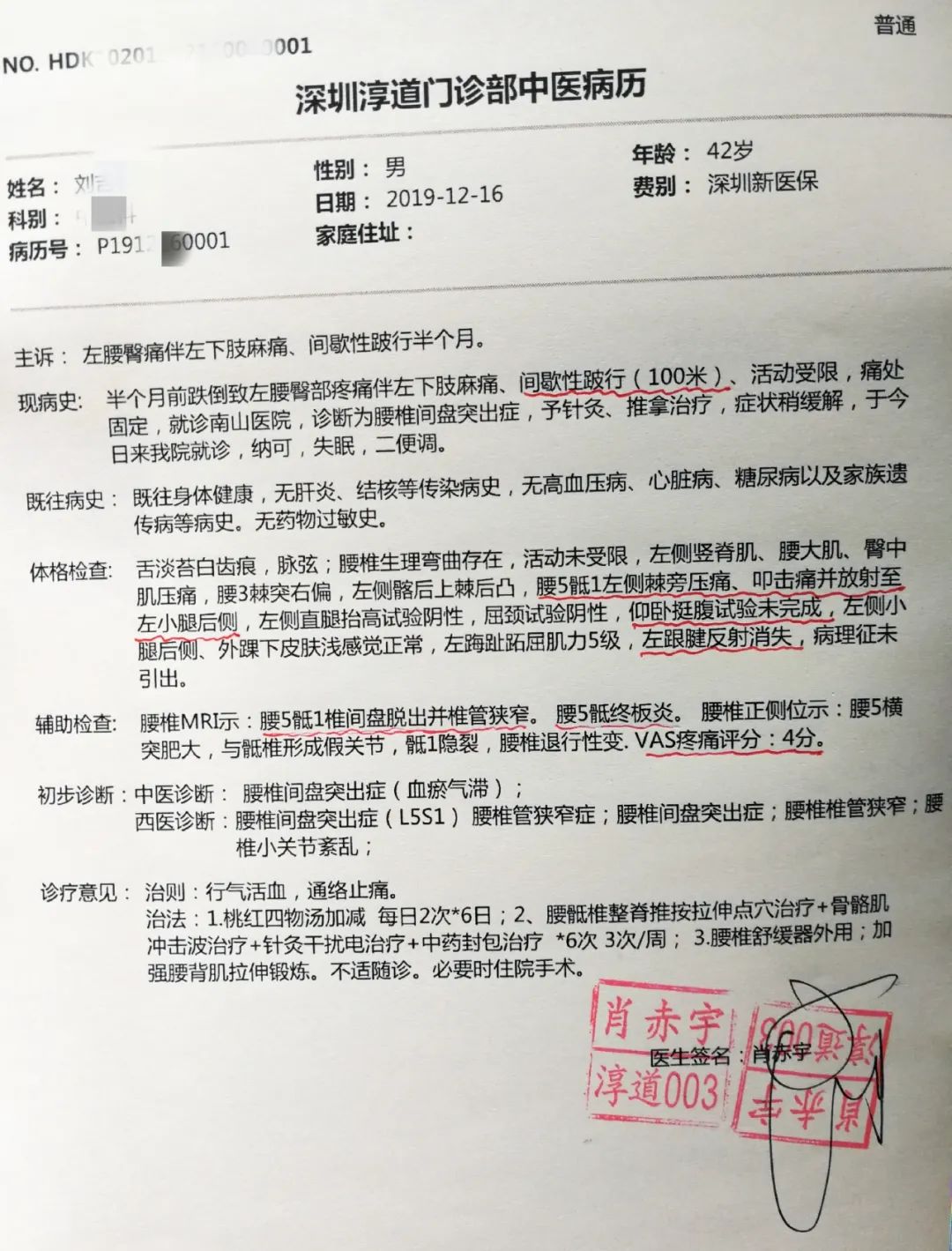 腰椎间盘突出症治疗，1个反射动作引出，提示治愈，医生很开心