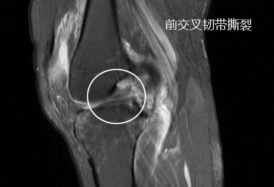 到底是手术好还是保守治疗好,保守治疗和手术治疗怎么选