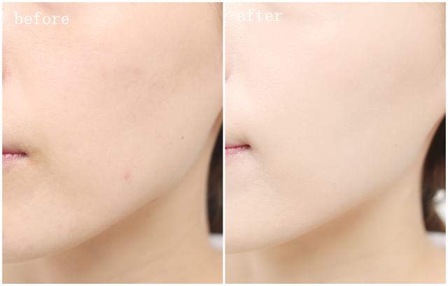 张韶涵坚持用护肤油5年，宋轶直接把油涂全身，难怪皮肤嫩出水